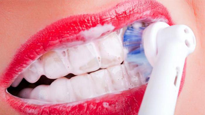 Zobu tīrīšana un pulēšana