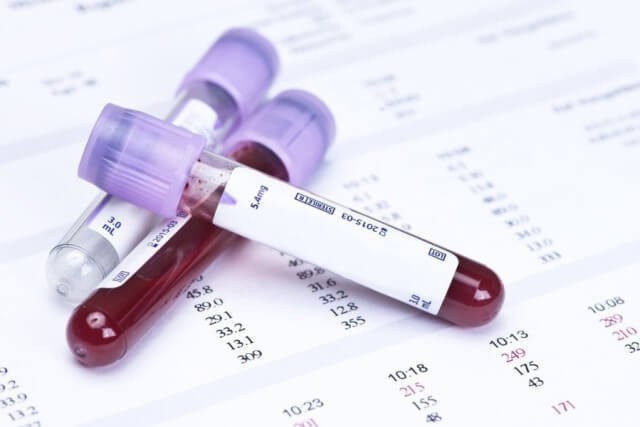 Kā iziet asins analīzi par sterilitāti?